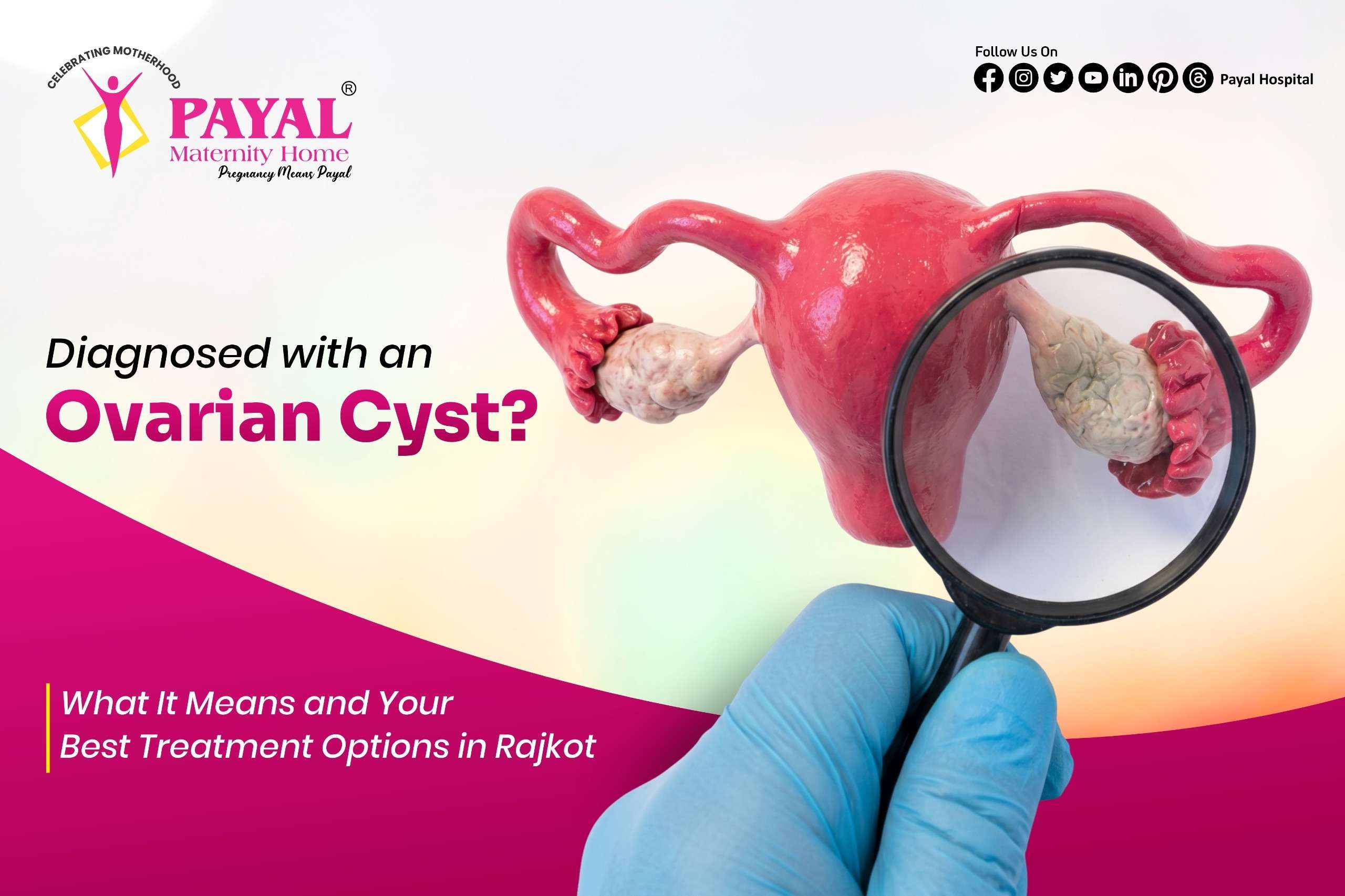 Diagnosed with an Ovarian Cyst?  What It Means and Your Best Treatment Options in Rajkot