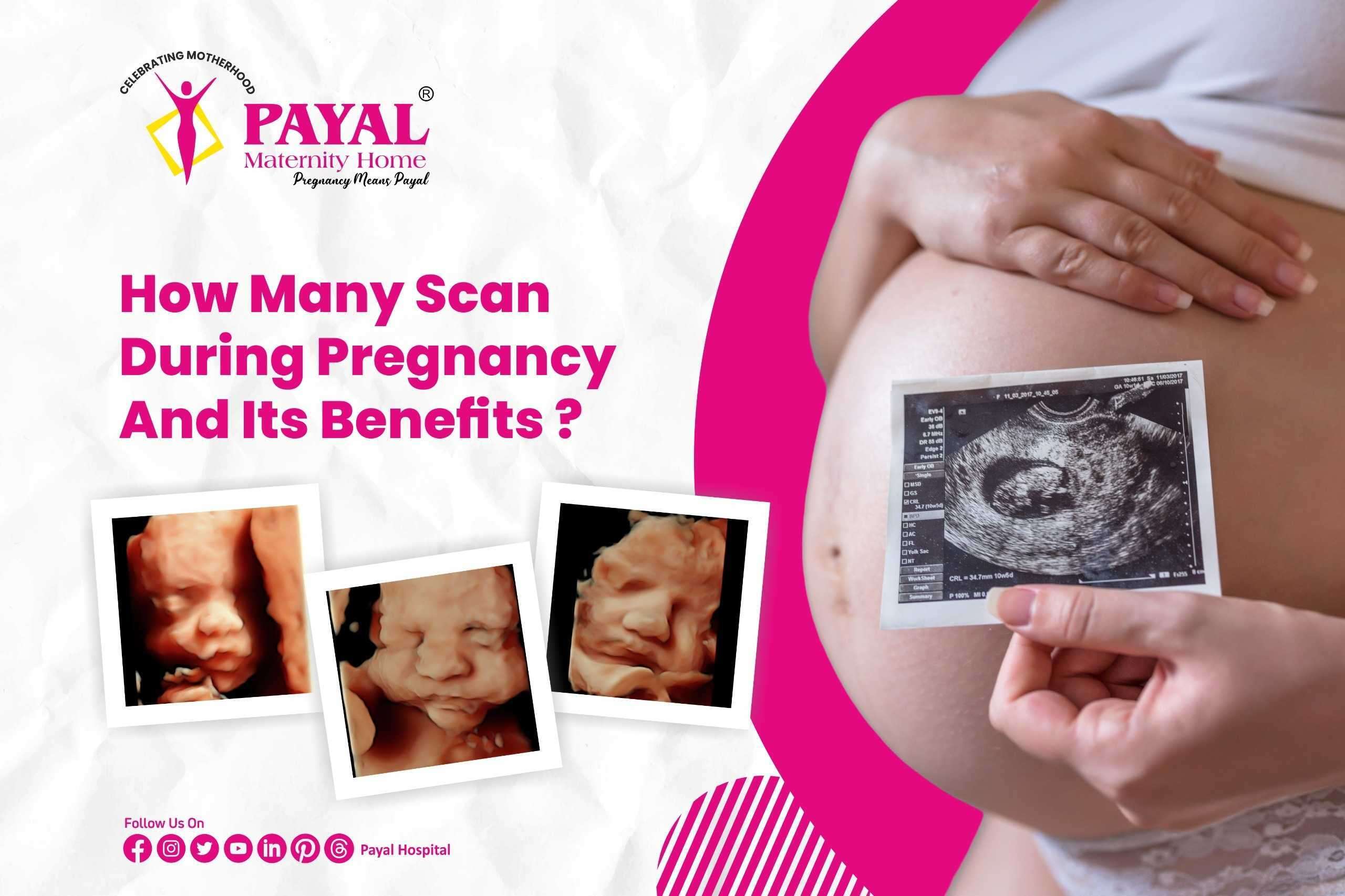 How many scans during pregnancy and benefits?